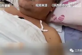 男子吸烟20年，结果3个脚趾坏死保不住了……警惕图片