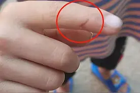 孩子补课班被狗咬伤后没打疫苗，四天后家长才知情，出事谁担？图片