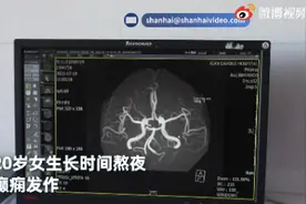 20岁女孩熬夜后倒地抽搐！医生：这种病一半是年轻人……图片