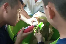 长沙一男孩手指被卡浴桶边孔洞内图片