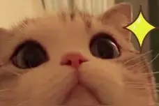 种瓜得瓜，种手得手！26岁小伙肚子里“长”出一截手指……图片