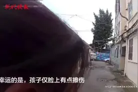 5岁女童四楼坠下，所幸仅脸上轻微擦伤图片