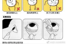 滴眼药水的正确方法图片