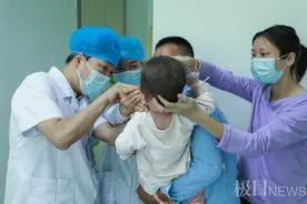 公益项目“伸援手”，大悟腭裂男童在汉免费手术图片