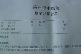 止血钳遗留在女子腹中超15个月：已被取出等鉴定图片