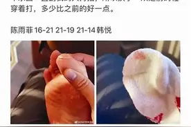 奥运冠军比赛时脚被“战靴”划伤图片