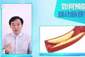 它是最怕堵的一根血管，严重可致命！4种方法帮你预防图片