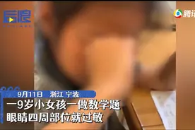 怪了！小女孩一做数学题就眼睛过敏，妈妈：做其他科目都没有反应图片