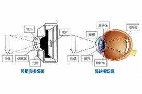 眼睛长“黄斑”别大意！延误治疗时机当心失明图片