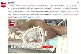 现实版“香妃”？新生儿全身散发甜甜的香味，洗也洗不掉！竟然是一种病图片