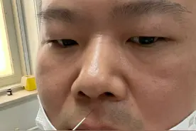 岳云鹏扎针灸晒照 画面搞笑却被医生嘱咐不许笑图片
