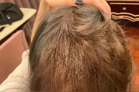 “我丑得出不了门！”女生花1000元染发成了这副模样：赔我20万！店长懵了……图片