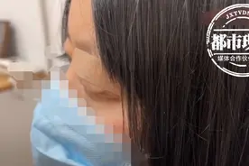 陕西一女子做双眼皮竟被切掉眼睑，6年不能闭着眼睡，彻底崩溃图片