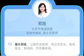 脱发和正常掉发有本质区别图片