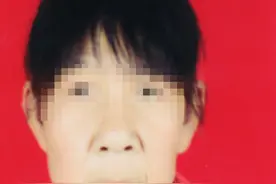 14岁少女皮肤下垂似老人，已在上海一医院做第一期整形手术图片