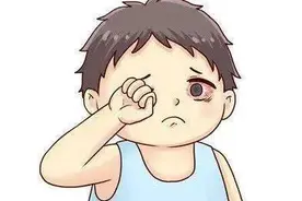 济南童康儿童医院：儿童总是眨眼睛是怎么回事？要警惕这5种原因图片