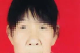 14岁少女“面容似老人”，将历经多期整形手术图片