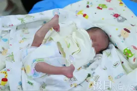稀奇！宝宝出生双腿翘上天，医生没开刀成功拉直图片
