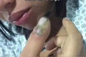 巴西一位女士误将假指甲粘在伤口上导致拇指被截掉图片