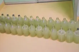 54岁大叔双肺洗出40瓶“牛奶”：患罕见肺病因气喘就诊视频封面
