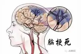 脑梗塞患者如何恢复？做到这几点很重要图片