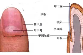 涨知识！原来指甲有斑点、竖纹、变厚竟预示着这些病…图片