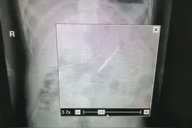 拍针、吞异物逃避强戒，这招不行啦图片