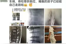 短短一个半月，车祸瘫痪男孩重新站起来，能走路了图片