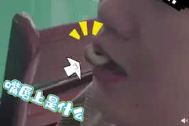 女子吃田螺吸住嘴唇求助消防员，网友评论笑疯！中国消防：这场面真不多见图片