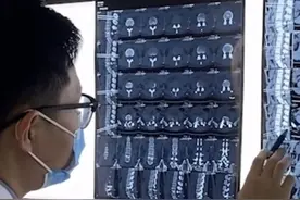 西安小伙一周吃3次烧烤，感染布鲁式菌病持续高烧一个多月视频封面