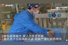 长沙一家长为婴儿挤脓包，结果送进ICU！医生提醒：类似情况需到医院就诊图片