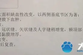 被爸爸举高高摔伤男婴已下3次病危通知 医生：恢复的希望不是太大图片
