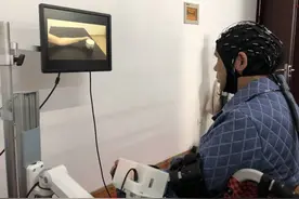 用意念操控实物，肢体本来无法抬举的他竟能自主活动了图片