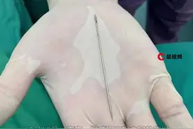 南京13岁男孩因好奇，将缝被子用的9厘米钢针塞入尿道，一两周后才取出！视频封面