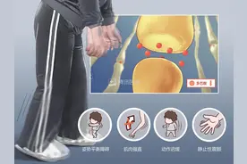 这5种走路姿势，藏着疾病秘密！第2种你可能也有图片