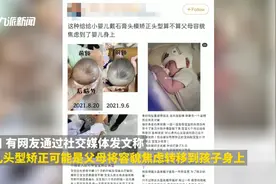 快评丨甘冒风险给婴儿戴头盔，如此育儿观更需“矫正”图片