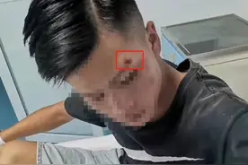 贵州一初中生在街头无故被打？警方：口角引发，打人者已到案图片