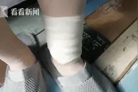 淋浴室玻璃门碎了，女子入住酒店全身被多处划伤图片