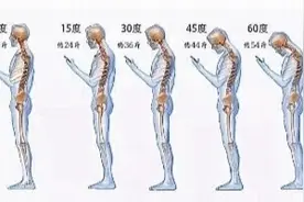 长时间低头 颈部上的“富贵包”可能成你的“夺命包”图片