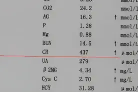 肌酐高是肾衰竭的早期警告，2个方法自然降肌酐，远离尿毒症图片