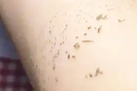 天天洗澡，你知道搓下来的“泥”到底是什么吗？快告诉家人还不晚视频封面