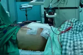 用热水"烫死"癌细胞？医生：40℃刚好，腹腔恶性肿瘤最适合图片