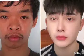 相貌不佳找工作屡碰壁 越南小伙数次整容蜕皮成美男走红泰网图片