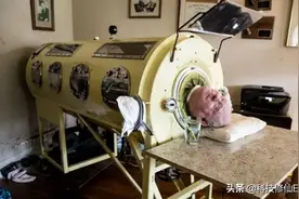 6岁因病躺进“铁桶”，躺了69年只剩头能动，唯有死亡能让他解脱图片