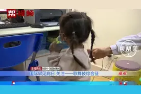 孩子长得太“漂亮”像化了妆的花旦，也是一种病？有这几种特征要警惕图片
