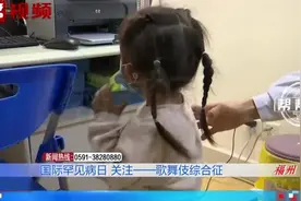 孩子长得太“漂亮”像化了妆的花旦，也是一种病？有这几种特征要警惕图片