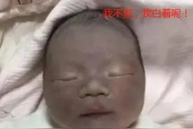 “黑脸宝宝”被亲妈嫌弃，护士却夸好看，2个月后高颜值逆袭图片