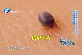 严重可夺命！10岁男孩遭“吸血鬼”钻进肚皮！户外出游要当心图片