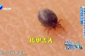 严重可夺命！10岁男孩遭“吸血鬼”钻进肚皮！户外出游要当心图片