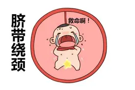孕期5个坏习惯，会导致胎儿脐带绕颈，孕妈要改进，别让胎儿受伤图片